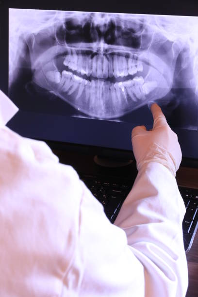 Best Emergency Dentist for Knocked-Out Tooth in Granite Bay, CA